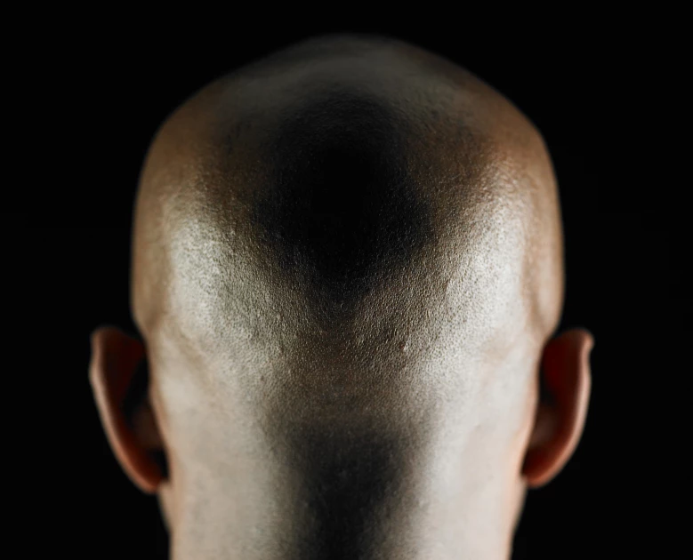 Calling a man 'bald' is sexual harassment, Court rules